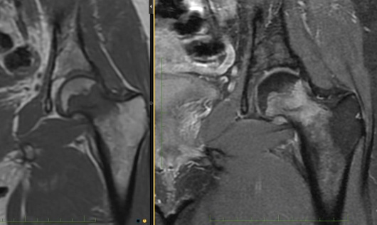 Figure 4 for case MALT lymphoma